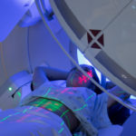 Photograph of throat cancer patient receiving radiation