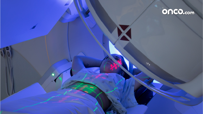 Photograph of throat cancer patient receiving radiation