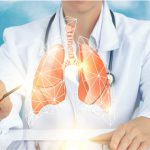 lung cancer life expectancy