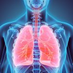 symptoms of lung cancer
