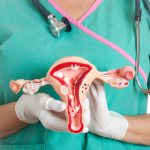 Photograph of surgeon holding a 3d scale model of the ovaries, to explain stage 3 ovarian cancer