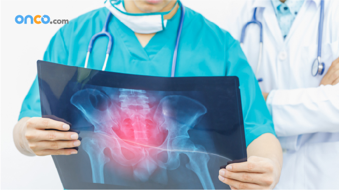 Picture of a doctor holding a X-Ray of the pelvis