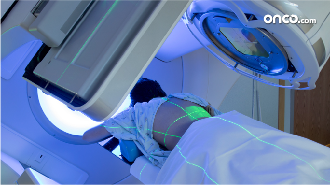 Picture of a patient receiving radiation therapy