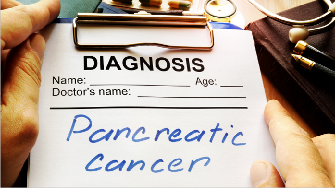 Picture of a notepad with the diagnosis as pancreatic cancer