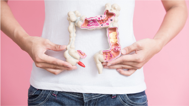 Picture of a person holding a large intestine