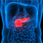 gallbladder cancer diagnosis