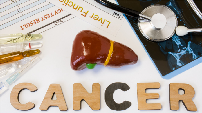 Picture of a 3D liver with the words cancer