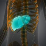 Visual representation of liver cancer