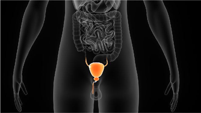 Visual representation of a human with testicular cancer