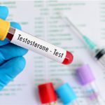 Picture of a doctor holding a vile with a testosterone test