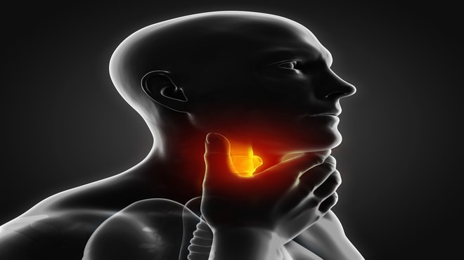 Visual representation of cancer affecting the throat