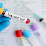 Picture of a thyroid test held conducted by a doctor