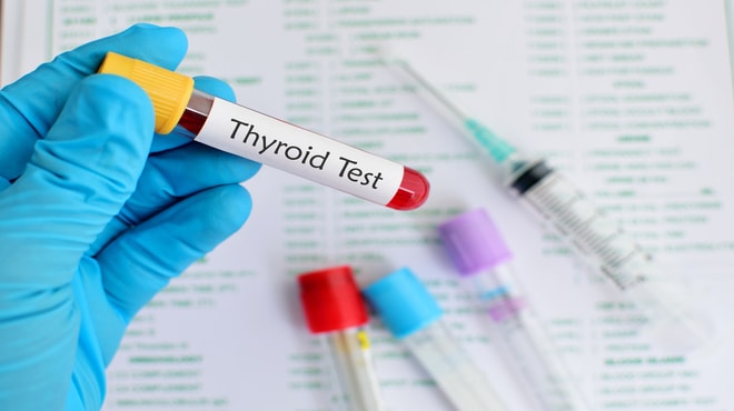 Picture of a thyroid test held conducted by a doctor