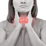 thyroid cancer causes