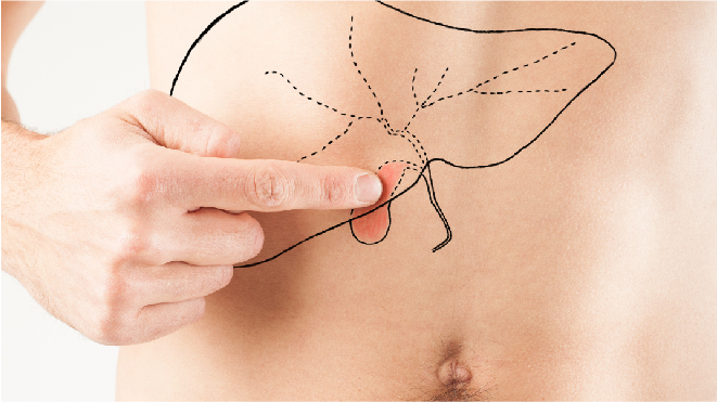 Patient pointing at an illustration of his gallbladder