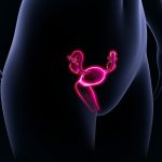 ovarian cancer treatment