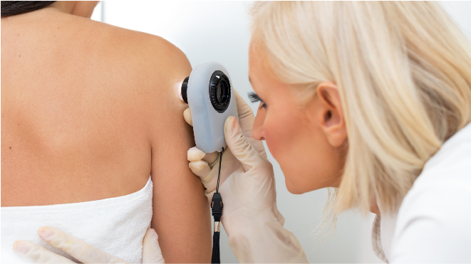 Picture of a doctor diagnosing the patient for skin cancer