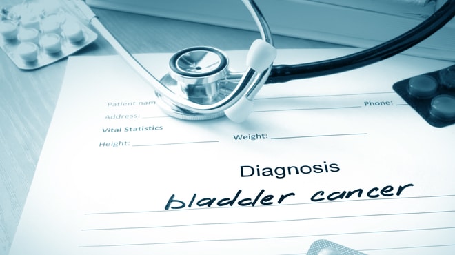 Bladder cancer diagnosis and urine cytology