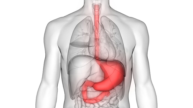 Visualisation of the affected area of stomach cancer