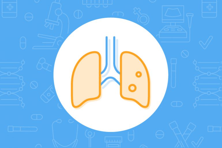 all about lung cancer