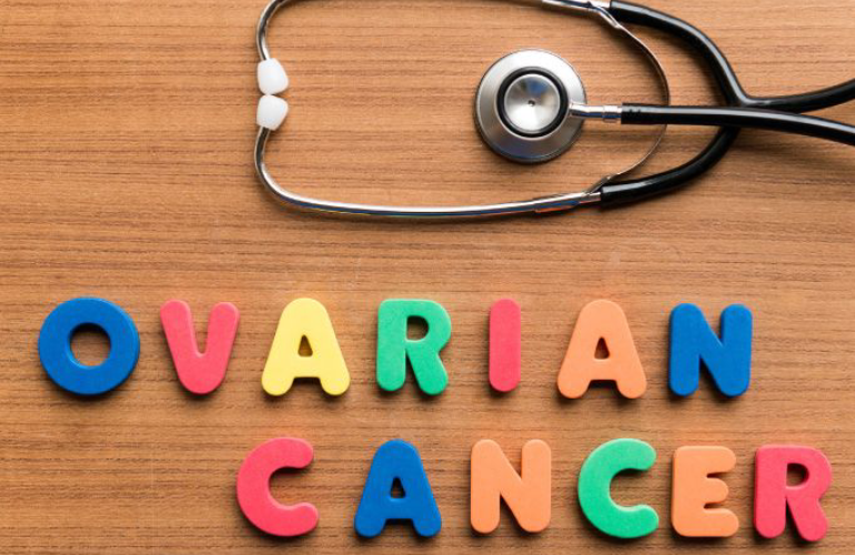 Questions to Ask About Ovarian Cancer