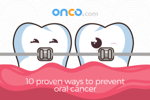10 proven ways to prevent oral cancer | Onco.com