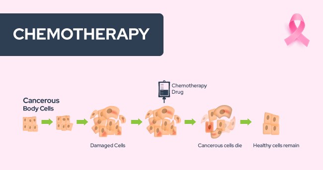 breast cancer chemotherapy
