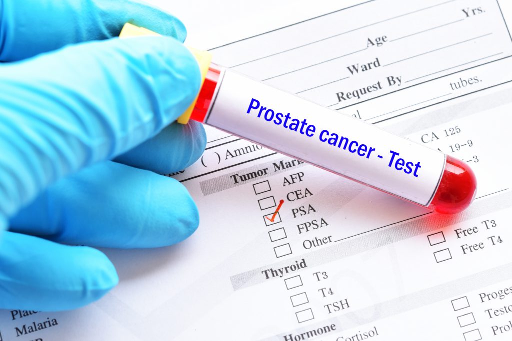 Blood Test Screening For Prostate Cancer Onco