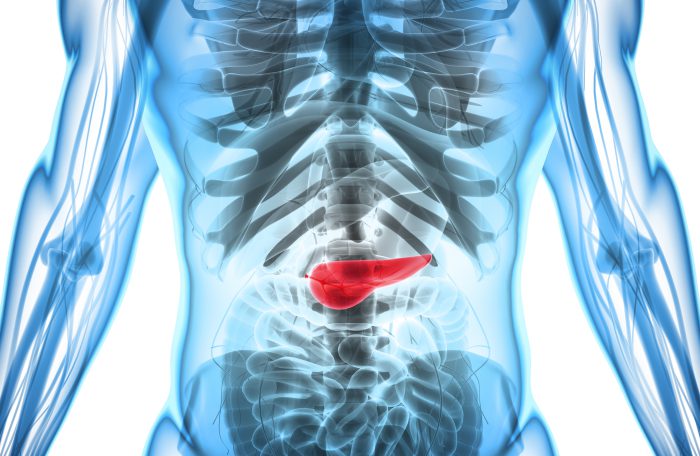 How is pancreatic cancer treated