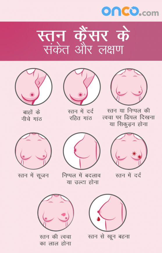 स्तन कैंसर के लक्षणों और संकेतों के बारे में जानें, इससे आपको आगे के लिए सचेत रहने में मदद मिलेगी