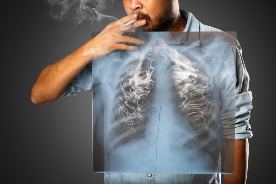 lung cancer risk