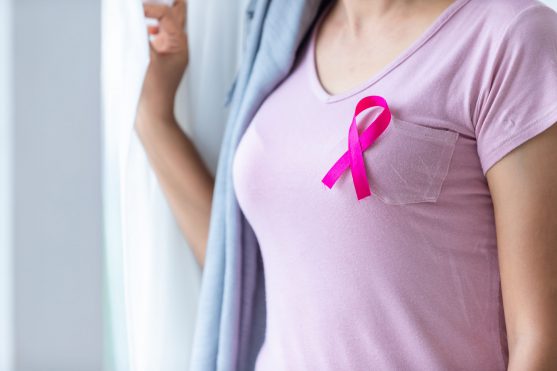 स्तन कैंसर कोशिकाओं की असामान्य वृद्धि है
