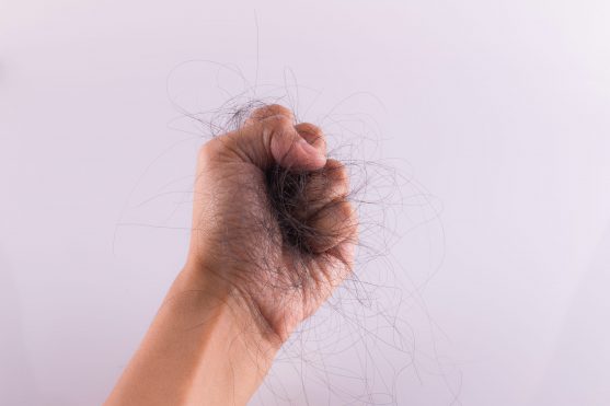 गंजापन (बालों का झड़ना) या कीमोथेरेपी के सबसे अधिक दिखाई देने वाले दुष्प्रभावों में से एक है।