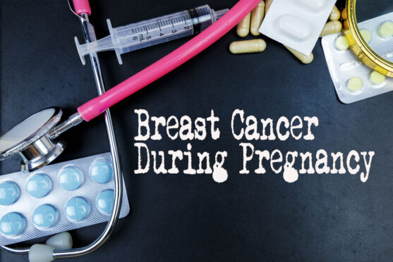 ब्रेस्ट कैंसर गर्भावस्था के दौरान होने वाला सबसे आम कैंसर है।