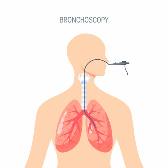 A lighting tube is inserted through the nose or mouth to examine the airways
