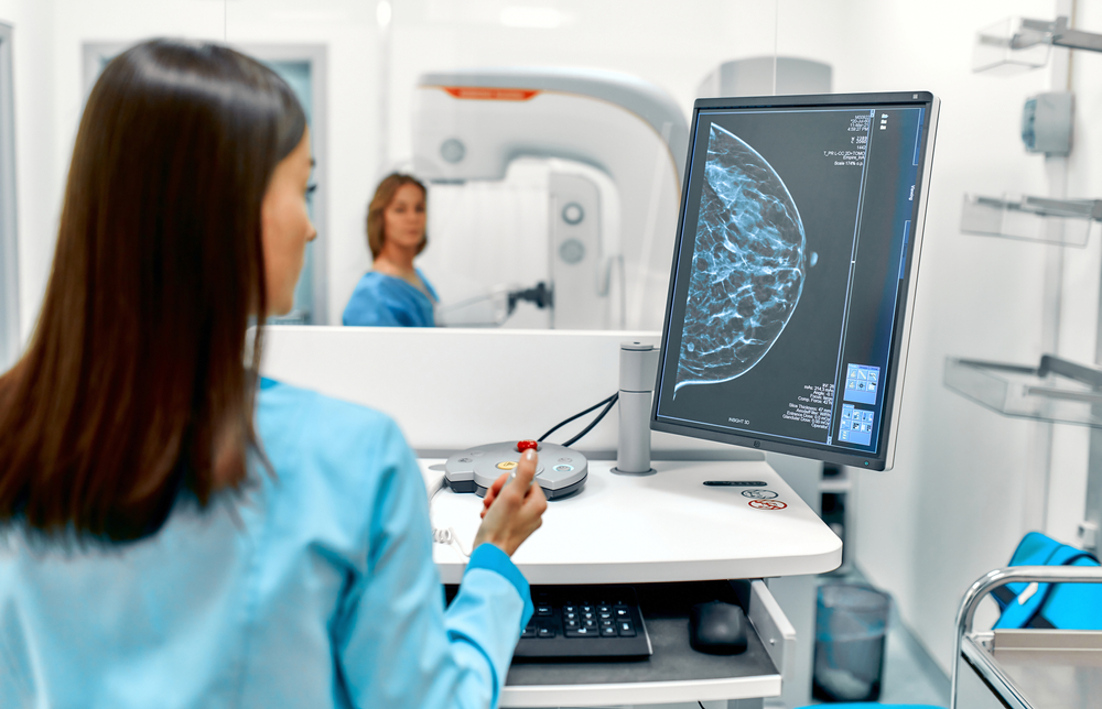 Breast cancer can be detected early by a Mammogram