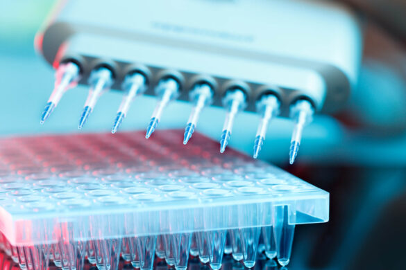 Breast Cancer Screening